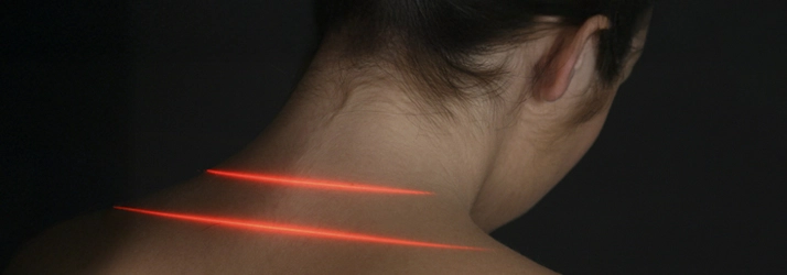 Patient with red lines on their neck.